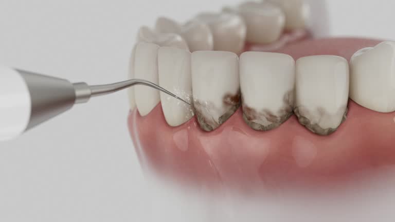 Reliable Dental Implants contractor in Plainfield, NJ by Smile Center Dentistry